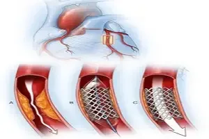 ¿Dónde puedo evaluar mi corazón con ecocardiograma sin esperar en Tijuana y Tecate?