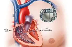 ¿Dónde revisar soplos cardíacos con ecocardiograma en Tijuana y Tecate?